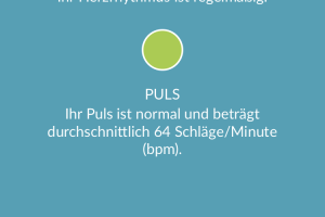 Ergometer – Pulsanzeige „spinnt“ – Update