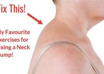 Fix your Buffel Hump