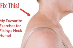 Fix your Buffel Hump