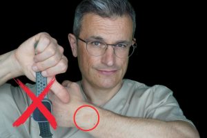 Warum ich meine Apple Watch nicht mehr trage – Dermatologische Risiken erklärt. Dr. Kasten