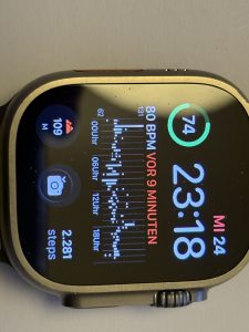 Apple Watch - werde ich damit...