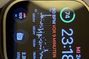 Apple Watch – werde ich damit glücklich ? – Update