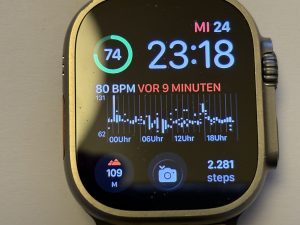 Apple Watch - werde ich damit...