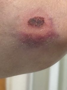 Gestern wäre es beinahe passi...