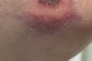 Gestern wäre es beinahe passiert …