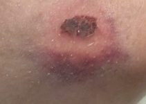 Gestern wäre es beinahe passiert …