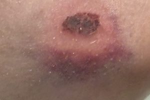 Gestern wäre es beinahe passiert …