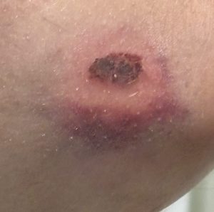 Gestern wäre es beinahe passi...